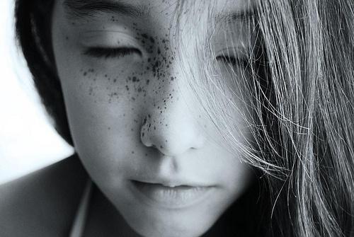 雀斑脸照片,探寻独特魅力的秘密