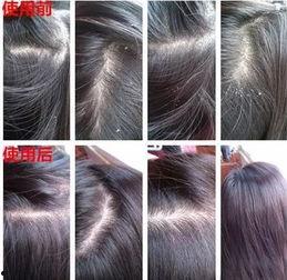 明星有头皮屑,揭秘明星护发秘籍